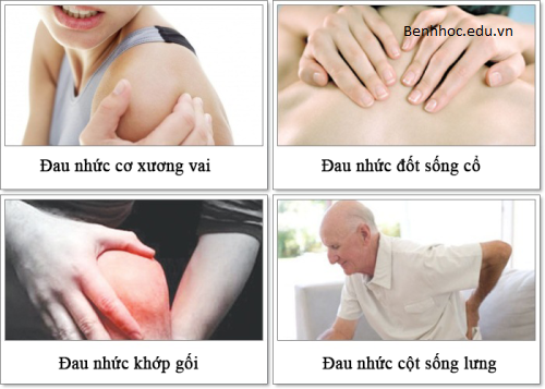 Dau-nhuc-xuong-khop-sau-khi-uong-ruou-bia-la-bi-benh-gi