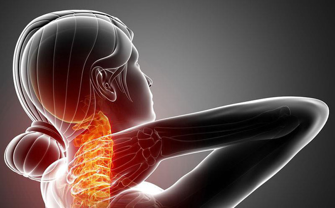 Đau mỏi vai gáy gây ra những cơn đau nhức ở vai, gáy và các vùng lân cận