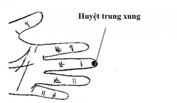 Vị trí huyệt trung xung trị cảm nắng