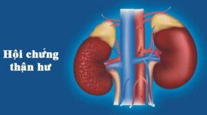 images thumb b444f30f 2507 418c b002 b9f5b42ae5b2