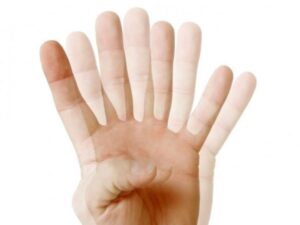 loan thi o tre nho e1671161799674