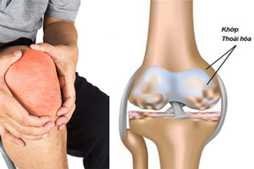 Cần quan tâm đến chính cơ thể của mình nhiều hơn nữa