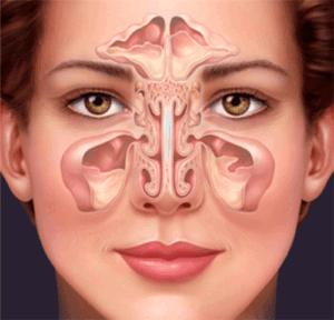 nhung dieu can biet ve benh viem xoang 1