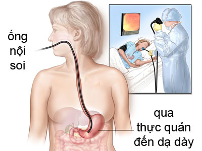 noi-soi-da-day-thuc-quan