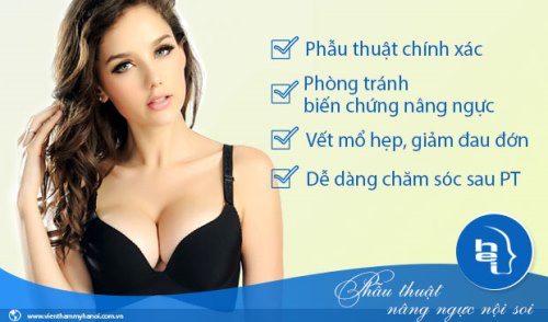 phau thuat nang nguc noi soi vtm ha noi 2