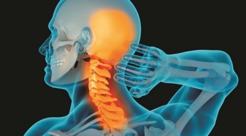 ìm hiểu triệu chứng gây nên thoái hóa đốt sống cổ