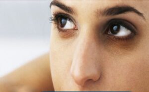 quang tham mat e1594456922465 1