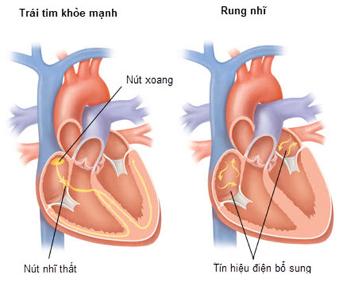 rung-nhi-can-benh-thuong-gap