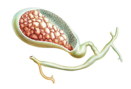 soi tui mat 1