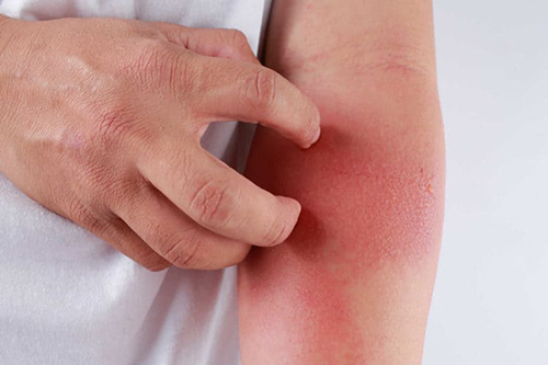 Những phương pháp được áp dụng trong điều trị bệnh viêm bao hoạt dịch