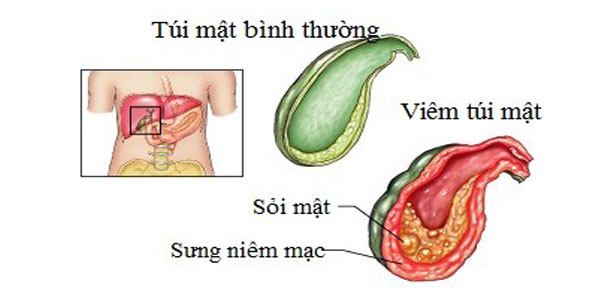 viem mat