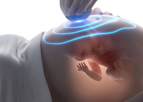 Thường xuyên kiểm tra thai kỳ nhằm phát hiện thiếu nước ối sớm và khắc phục