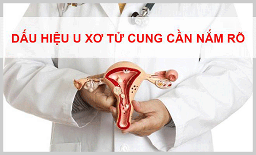 Nhận biết u xơ tư cung sớm để điều trị nhanh chóng