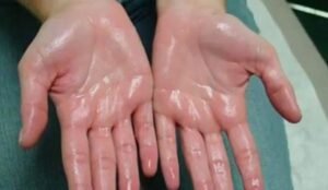 mo hoi tay e1599813626581 2