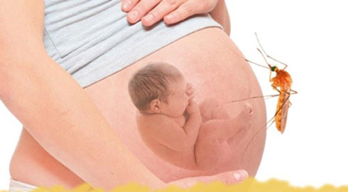Những nguy cơ sốt xuất huyết khi mang thai